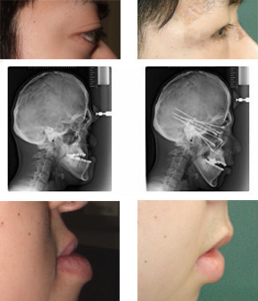 慶應義塾大学医学部 形成外科 頭蓋顎顔面外来