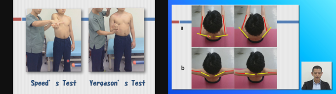 肩関節周囲炎に対する理学療法【DVD3枚組・分売不可】 肩関節周囲炎