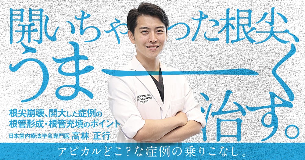 大臼歯の外科的歯内療法｜歯科オンラインセミナー・録画配信は1D