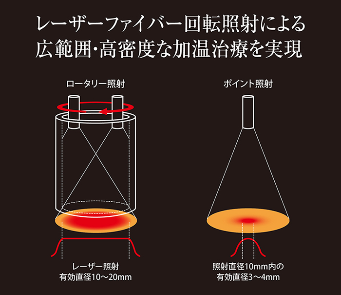 ロータリーハンドピース | 飛鳥メディカル 〜レーザー治療の可能性を