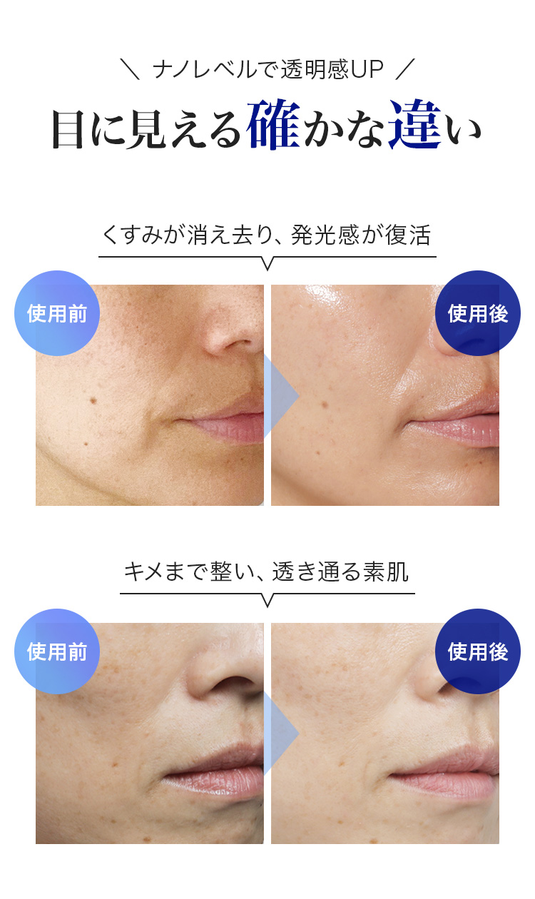 QuSomeホワイト2.0 | スキンケア化粧品・サイエンスコスメのビーグレン