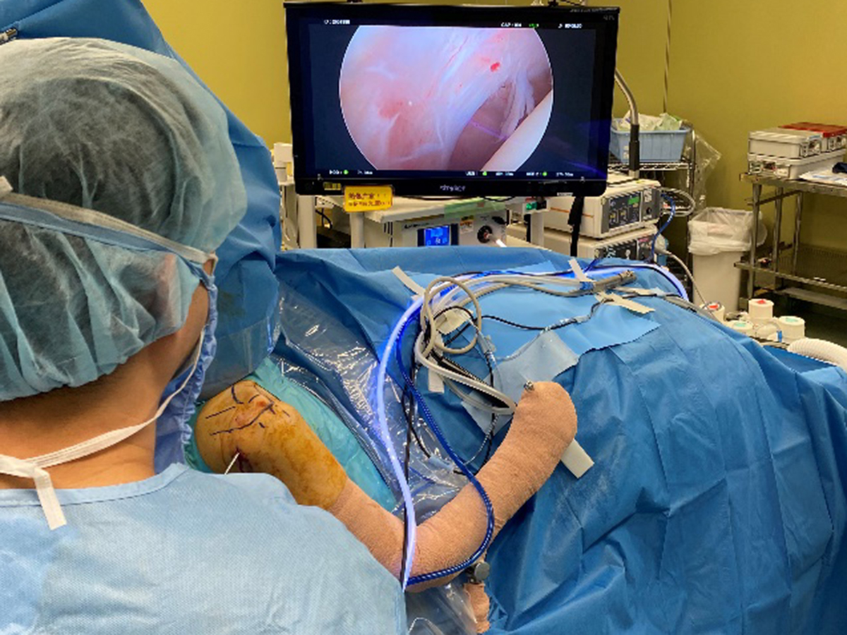 関節鏡視下手術 – 三田市民病院