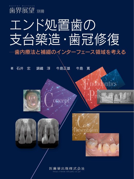 月刊「歯界展望」別冊 エンド処置歯の支台築造・歯冠修復 歯内療法と