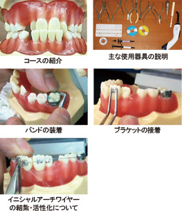 入門実習編【ベーシックコースDVD】 << 各種タイポドント矯正DVD