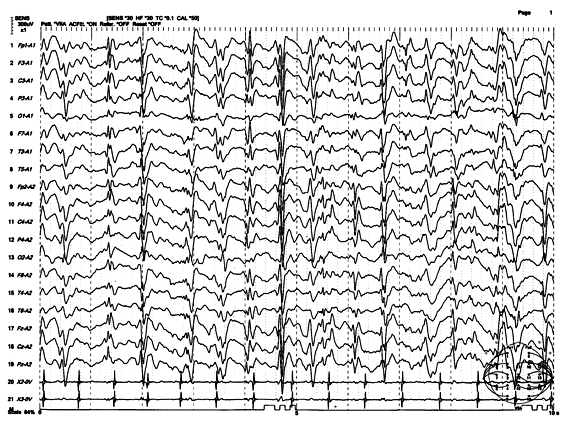 検査案内 | 【公式】 大阪市立総合医療センター