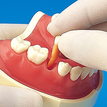 複製歯牙着脱模型 [PE-ANA009(I21D-400C)]｜株式会社ニッシン｜歯科