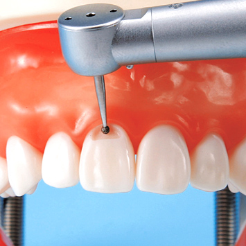 保存修復実習用顎模型 [D18D-500E(GUB)](D咬合器つき)｜株式会社