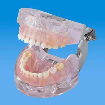 乳歯冠用支台歯形成歯 [A70AN-174]｜株式会社ニッシン｜歯科模型・歯科