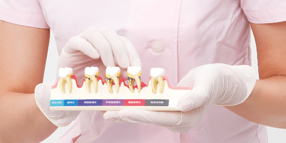 乳歯冠用支台歯形成歯 [A70AN-174]｜株式会社ニッシン｜歯科模型・歯科