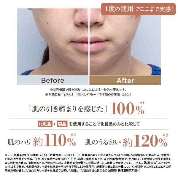 フォトプラス ディープリフト｜ヤーマン公式通販サイト | ヤーマン