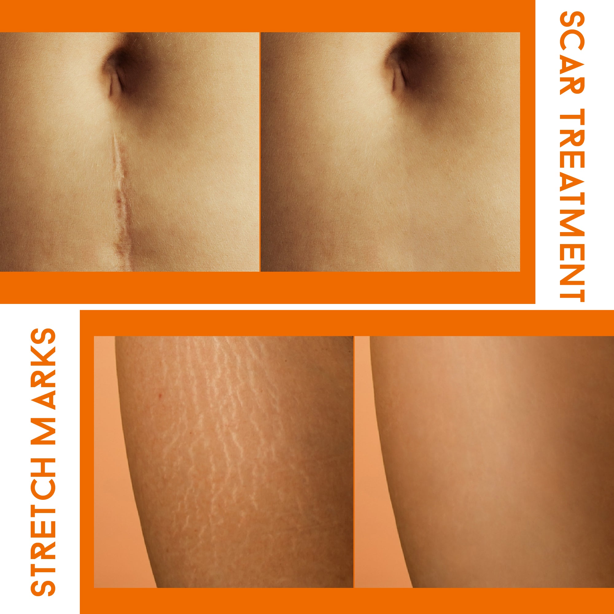 CHRISTMAS SALE 70% - ABERA Red Turmeric Scar Removal Cream