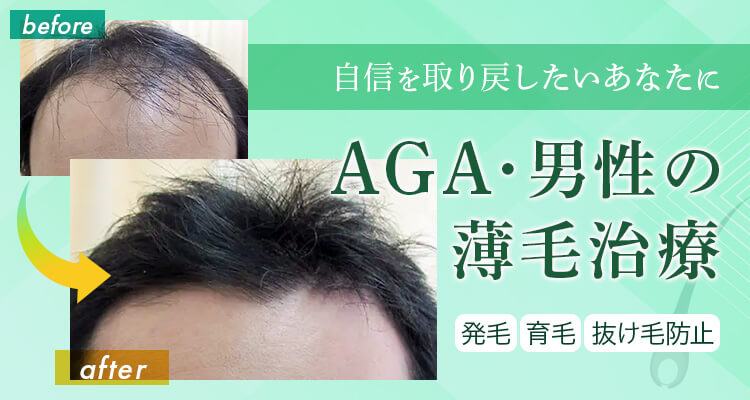 薄毛治療・AGA｜福岡市博多区の美容皮膚科【あやべクリニック】