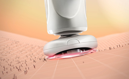 シェーバー 温剃り ホットシェイブ スキンプロ ヤーマン 髭剃り