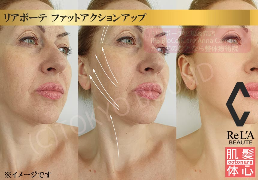 リアボーテ正規販売店】クレアスキン ファットアクションアップ（美容