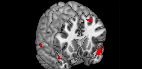 brain-mr-autism.jpg?w=1600&h=