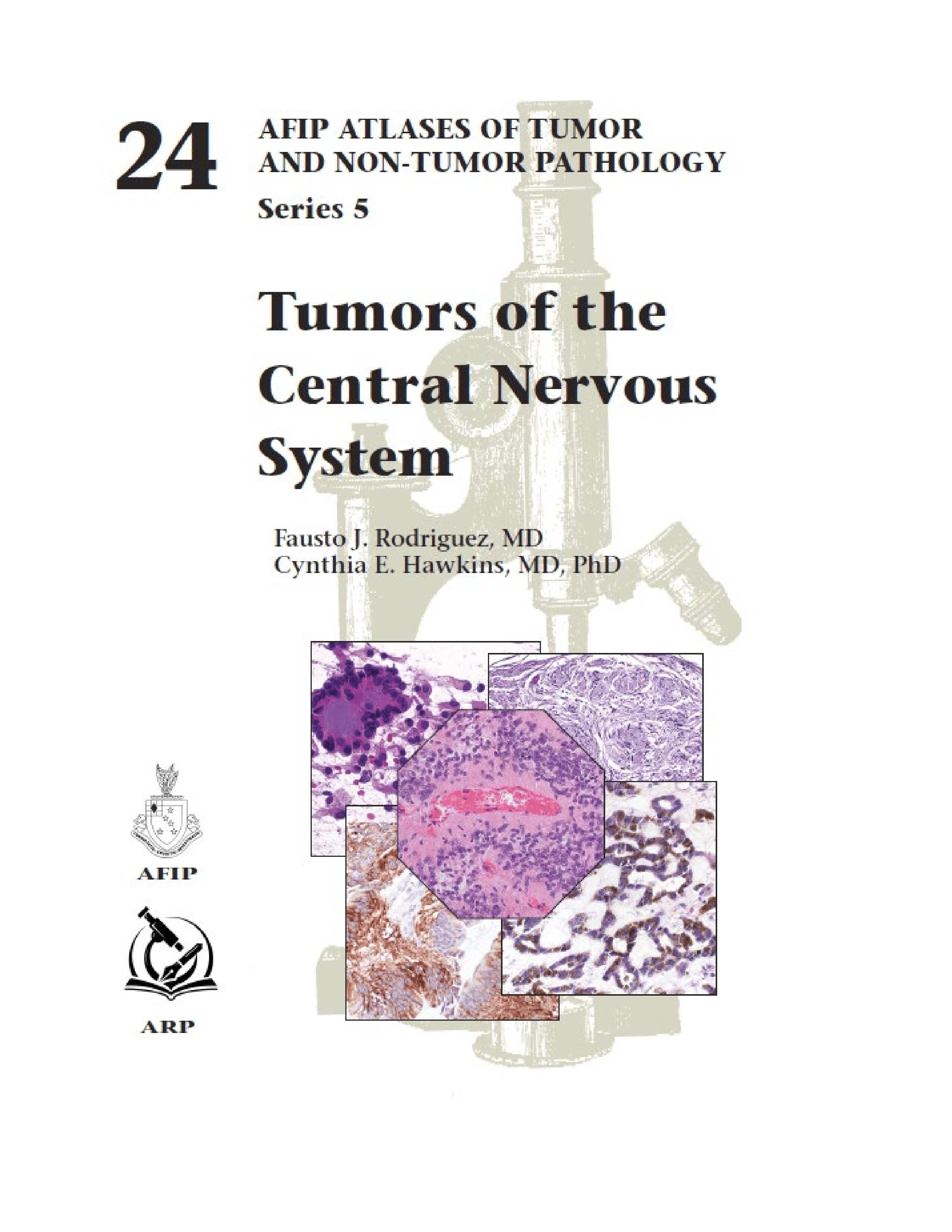 Atlases of Tumor & Non-Tumor Pathology, 5th Series, Fascicle 24