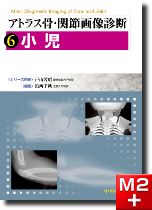m3電子書籍 | アトラス骨・関節画像診断 6.小児