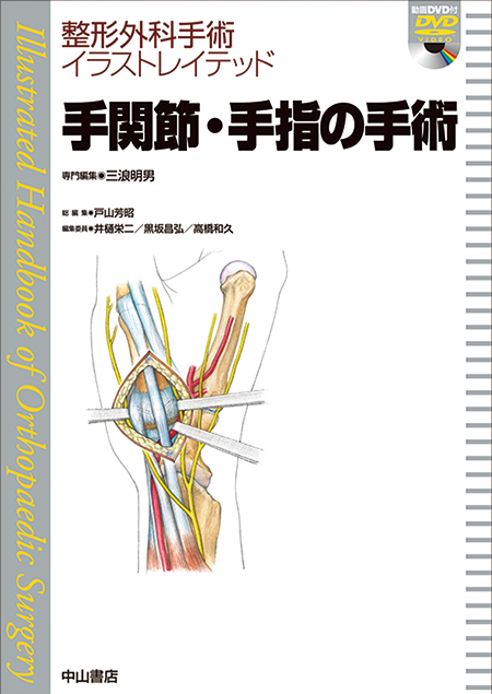 m3電子書籍 | 整形外科手術イラストレイテッド手関節・手指の手術