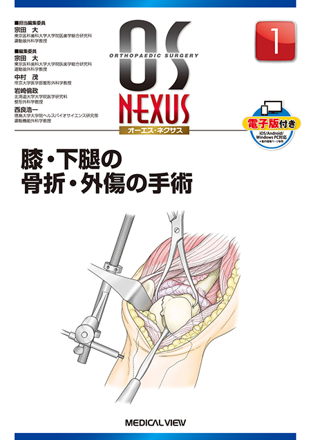 m3電子書籍 | 新OS NEXUS No.10 股・膝関節の鏡視下手術［Web動画付］