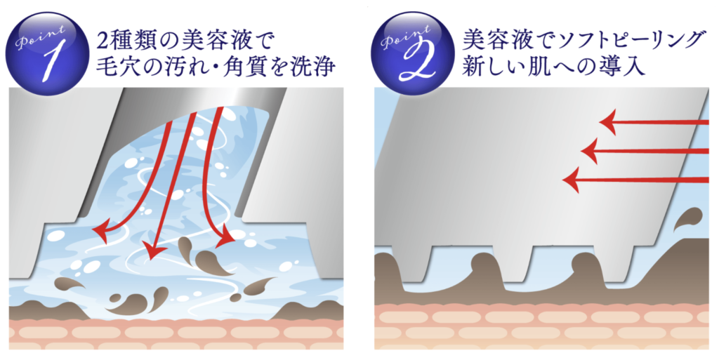 業務用フェイシャル美容機器｜アクアエラの特徴や効果、価格についてご