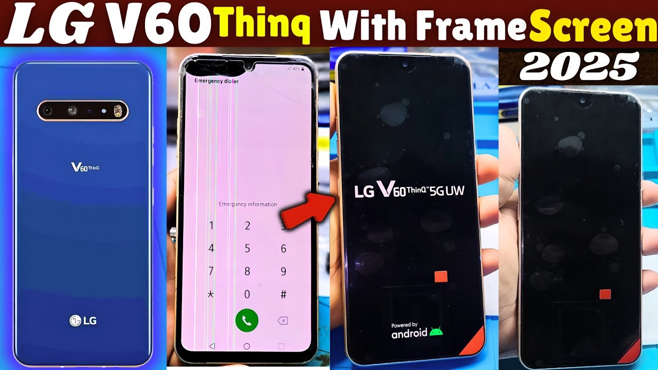 Lg V60 Thinq 5G With Frame Screen 📲 Replacement 2025