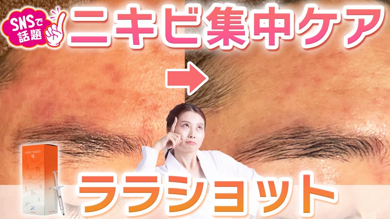 ニキビ肌必見！】ニキビ・黒ずみを集中ケア！ LHALA SHOT Q -ララ