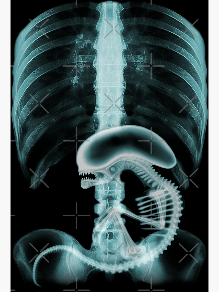 Alien radiography v2, Alien X-ray v2, blue