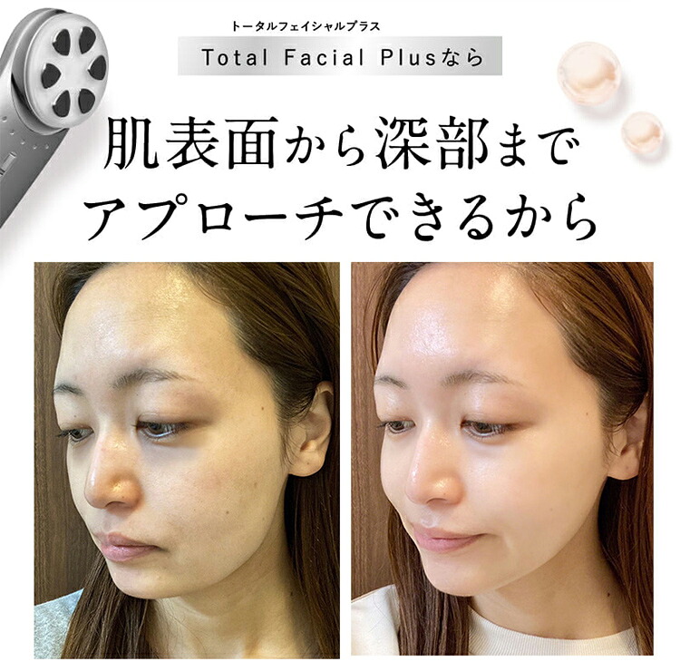 楽天市場】MELLIFE トータルフェイシャルプラス 美顔器 リフトアップ
