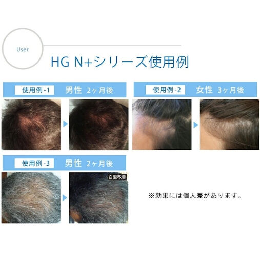 ハーグ ( HARG ) 薬用HGドクターズヘアケアシリーズ HG MD® シャンプー