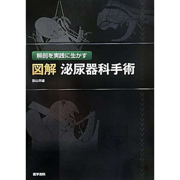 Amazon.co.jp: イラストレイテッド泌尿器科手術―図脳で覚える術式と