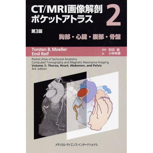 CT/MRI画像解剖ポケットアトラス 第3版 第1巻 頭部・頸部 | 町田 徹