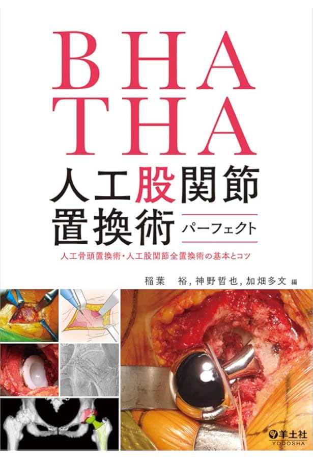 TKA・UKA 人工膝関節置換術パーフェクト〜人工膝関節全置換術・人工膝