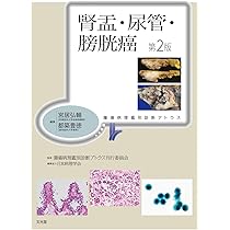 腎盂・尿管・膀胱癌 第2版(腫瘍病理鑑別診断アトラス) | 宮居 弘輔