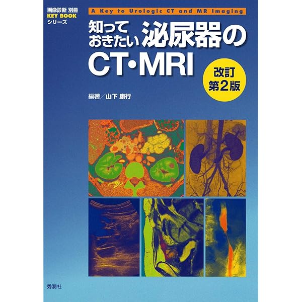 婦人科MRIアトラス 改訂第2版 (画像診断 別冊KEYBOOKシリーズ) | 今岡