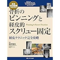 Amazon.co.jp: 「考える」外傷整形外科! : 土田 芳彦: 本