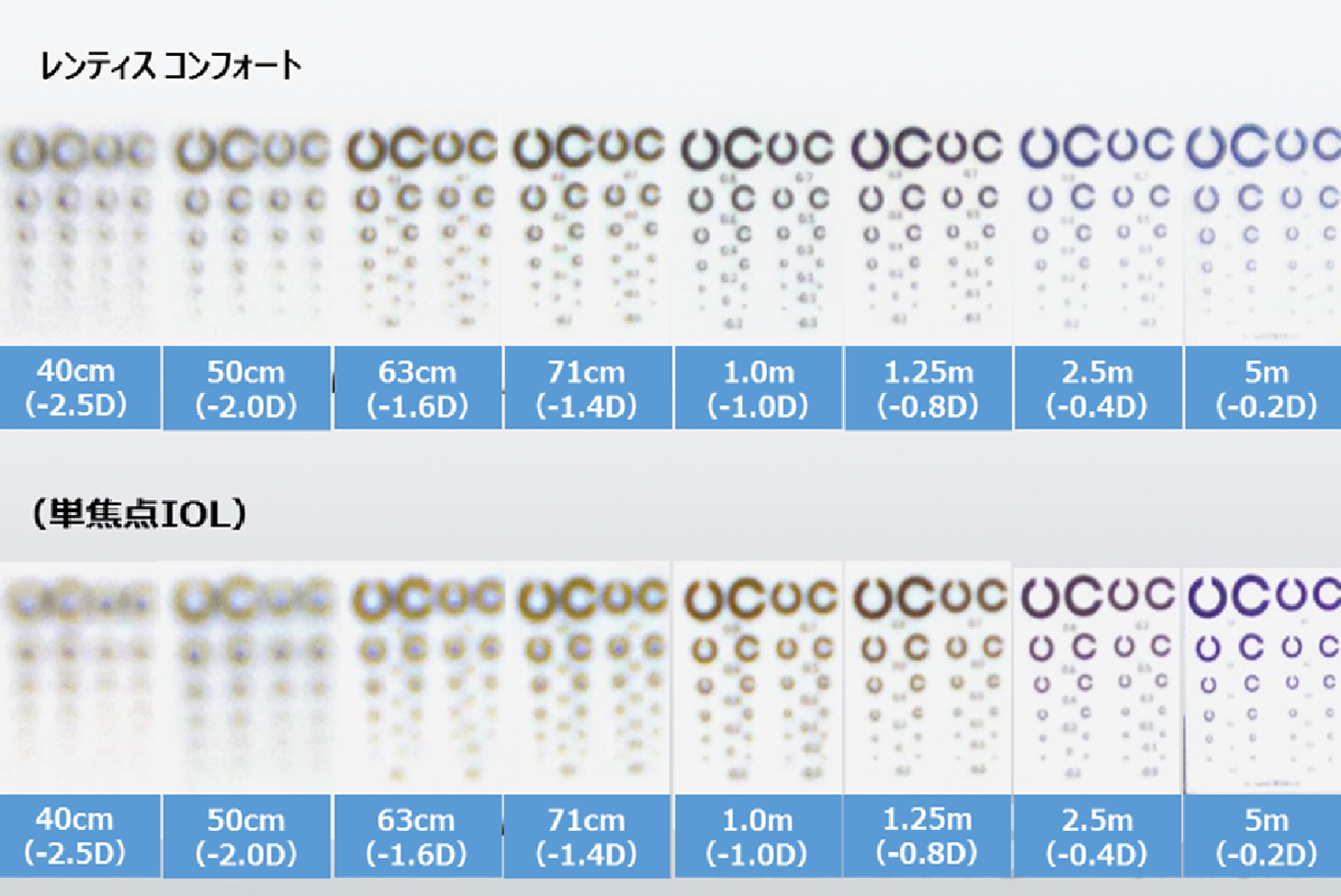当院で採用している眼内レンズ（LENTISとEyhanceについて） - 芦屋市の