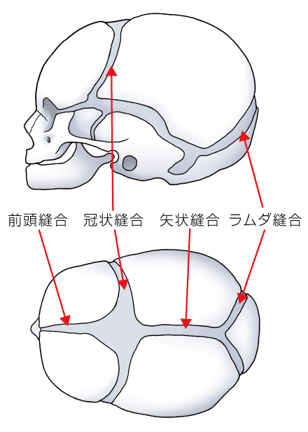 頭蓋骨縫合早期癒合症｜一般社団法人 日本頭蓋顎顔面外科学会