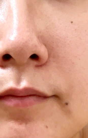 クエスクVA1セラム | スキンケア化粧品・サイエンスコスメのビーグレン