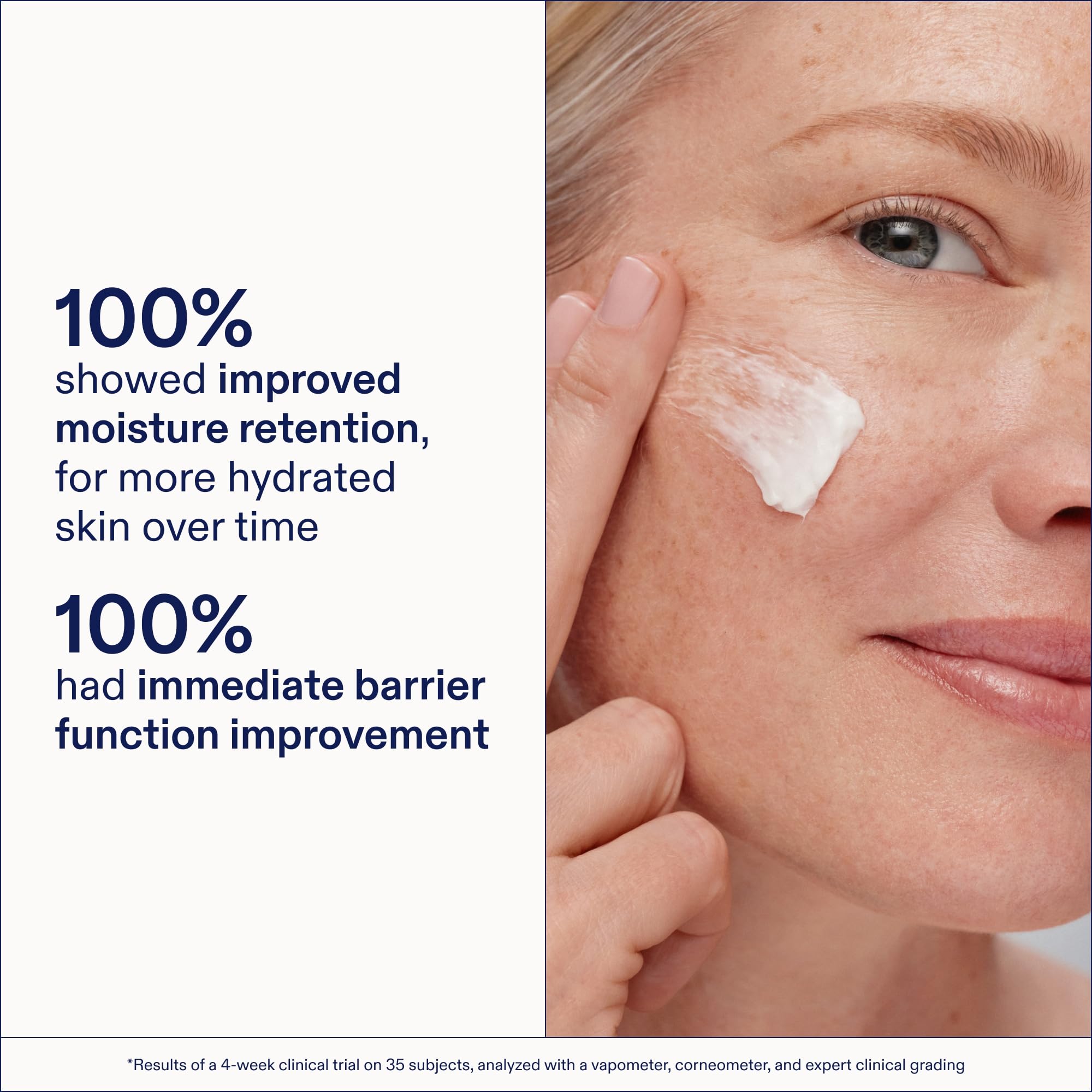 Amazon.com: Skinfix Triple Lipid-Peptide Cream Refill - 1.7 oz