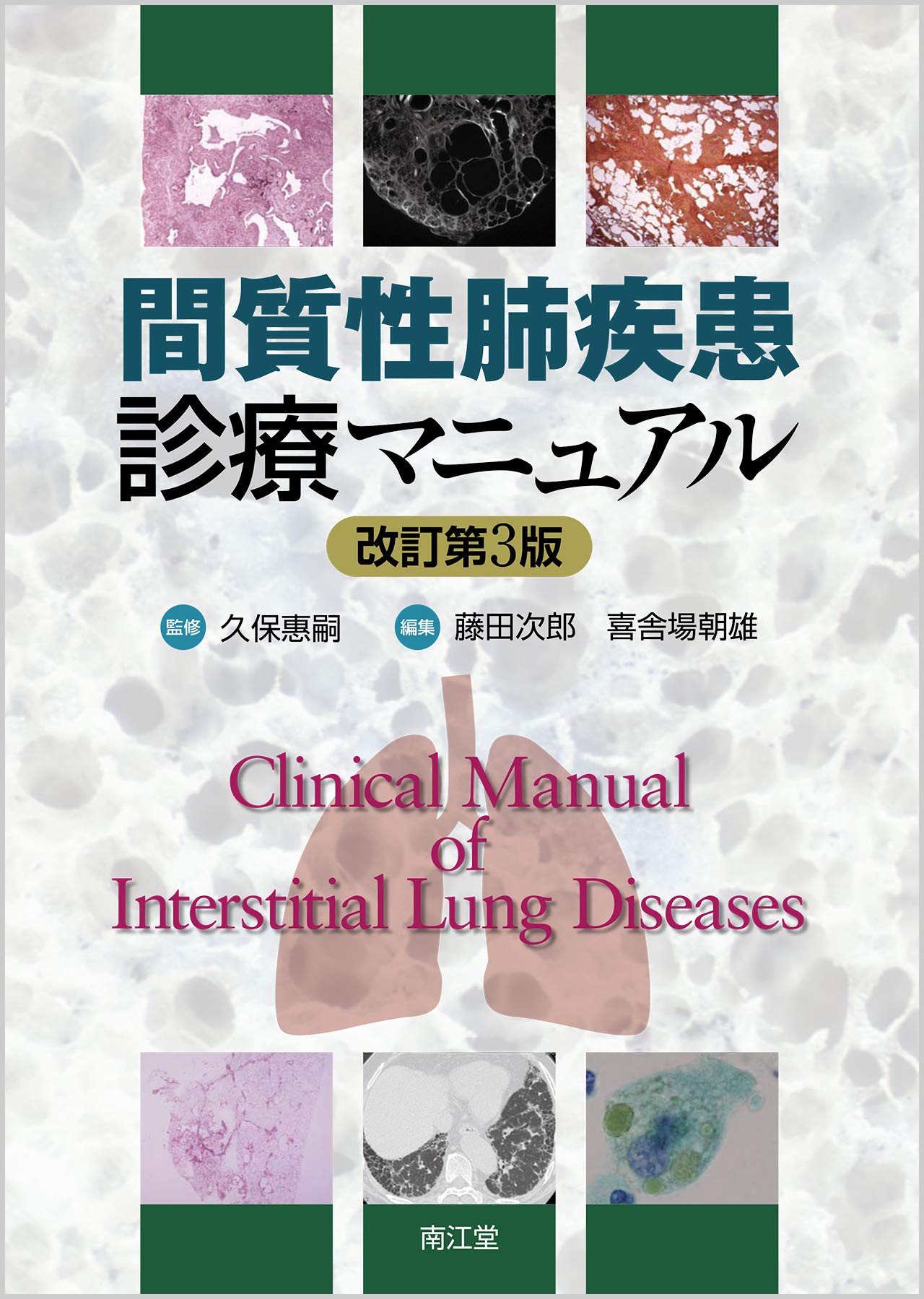 Amazon.co.jp: 間質性肺疾患診療マニュアル(改訂第3版) : 久保 惠嗣