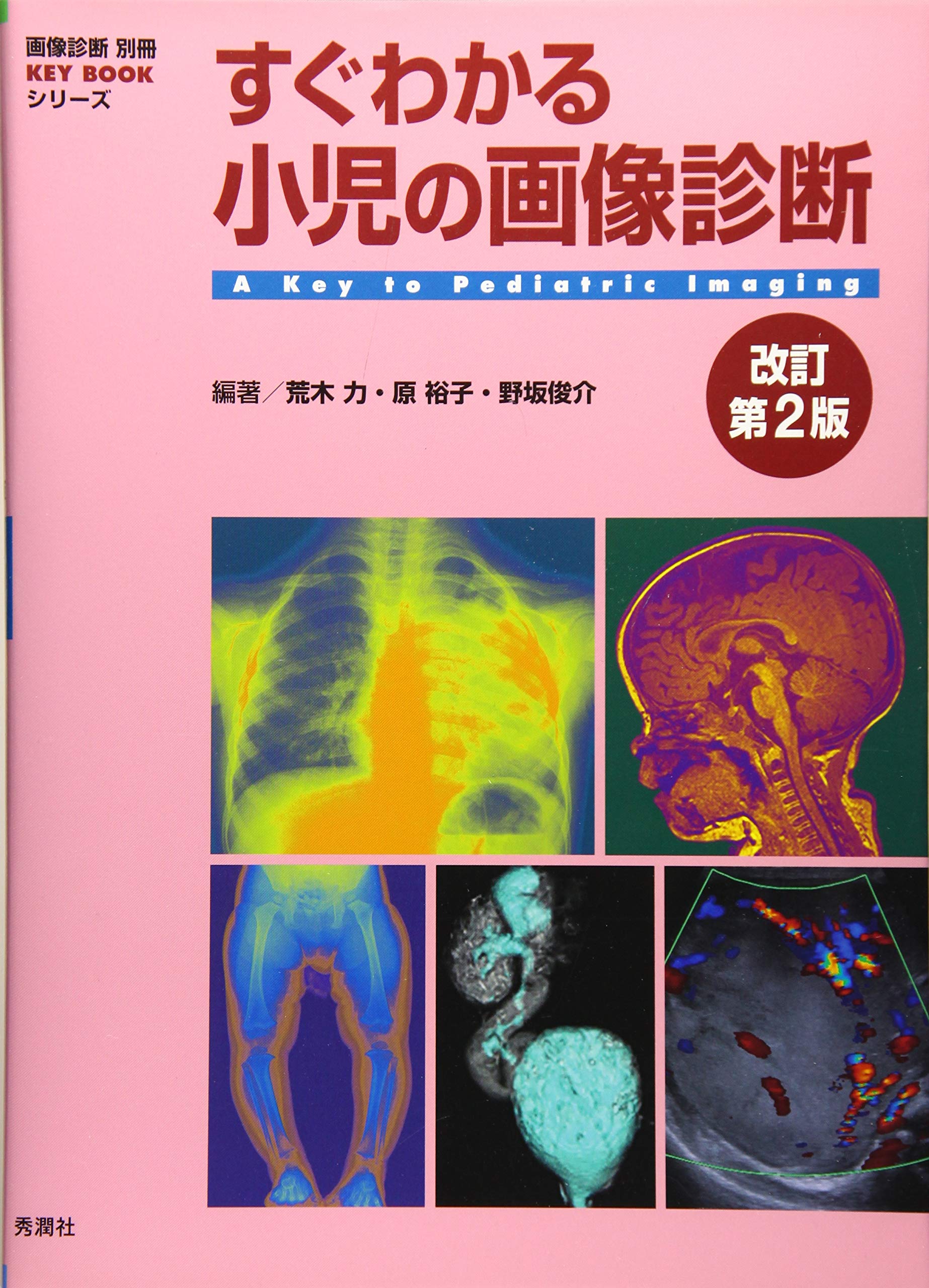 すぐわかる小児の画像診断 改訂第2版 (画像診断別冊KEYBOOKシリーズ