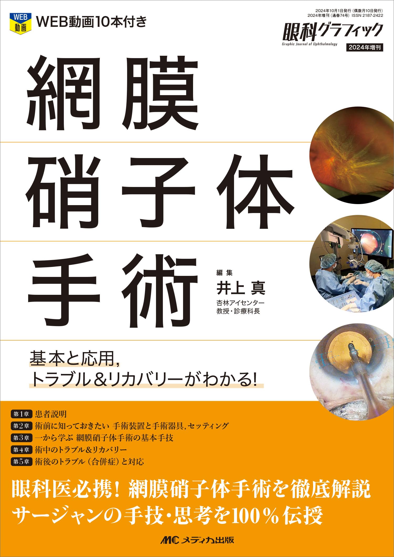 網膜硝子体手術：基本と応用，トラブル＆リカバリーがわかる！ (眼科