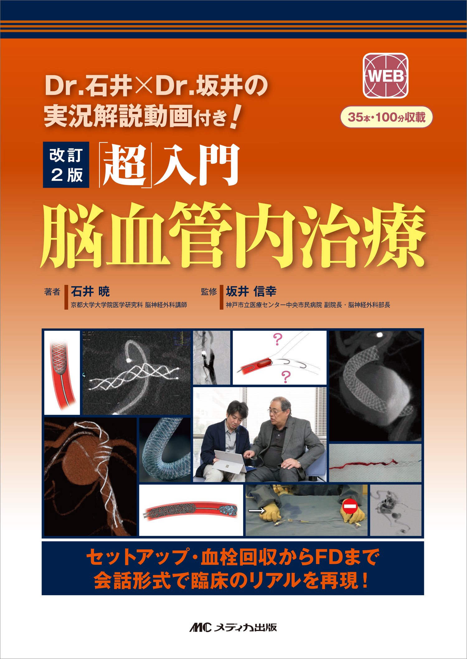 Amazon.co.jp: 改訂2版 「超」入門 脳血管内治療: Dr.石井×Dr.坂井の