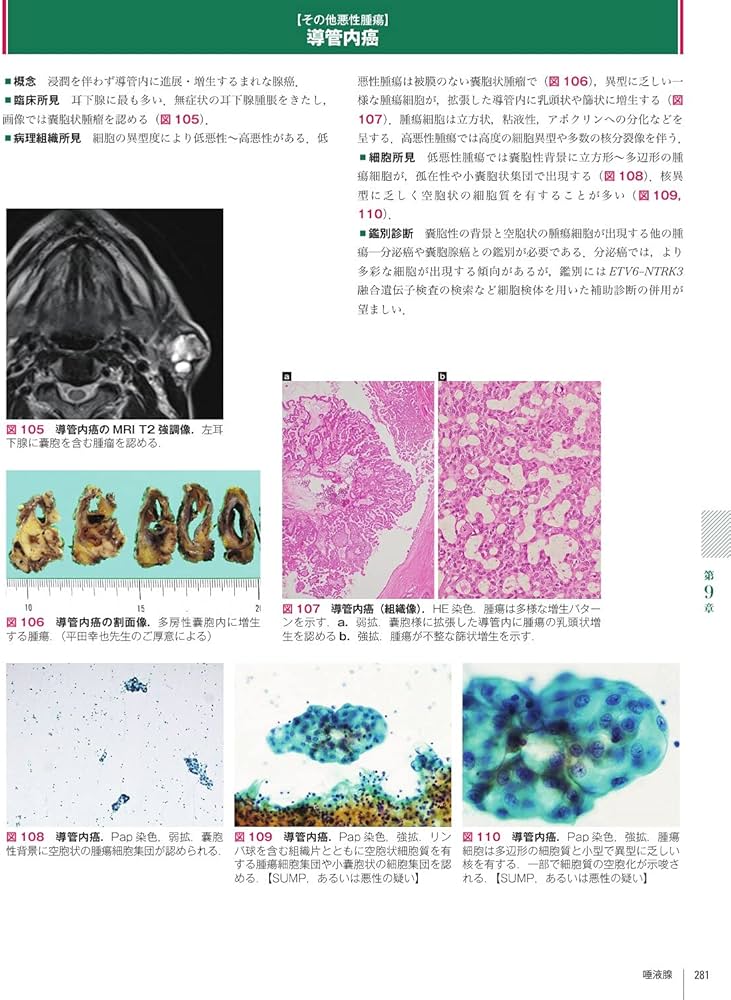 Amazon.co.jp: 細胞診鑑別アトラス : 金城 満: 本