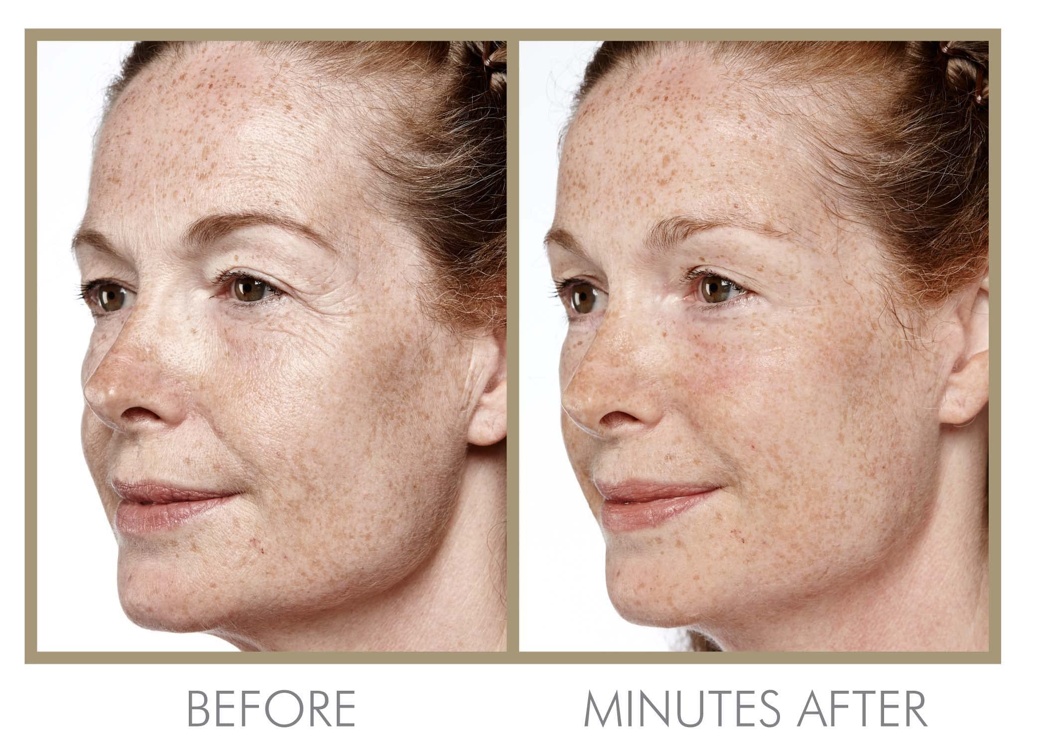 Amazon.com: GENIE Instant Line Smoother (30 ml/1 fl oz) : Beauty