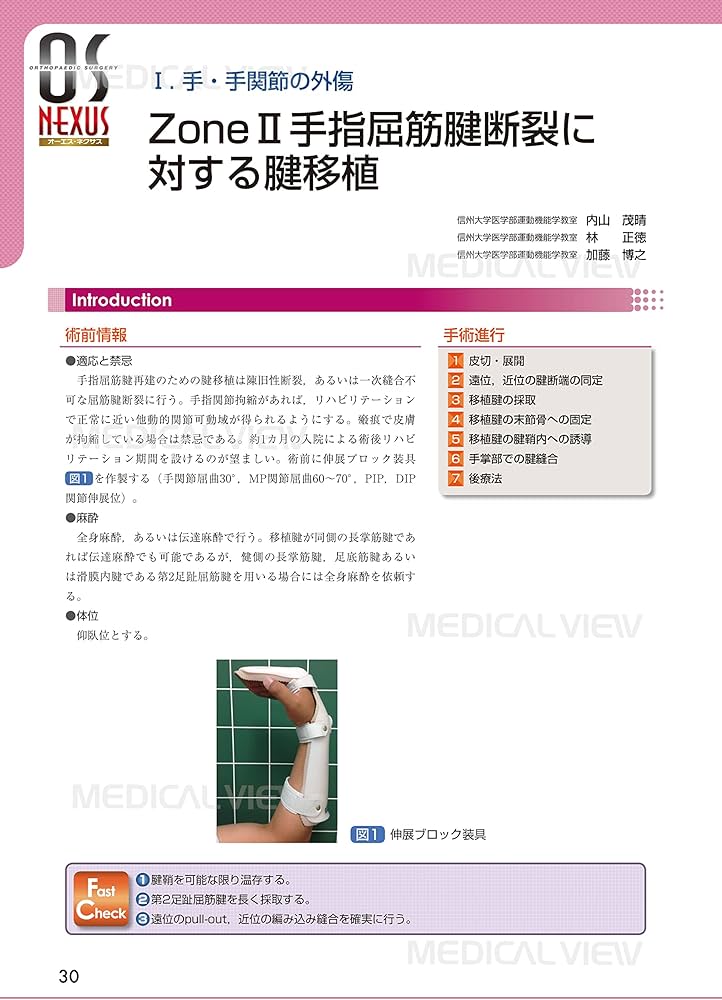 Amazon.co.jp: 手・手関節の骨折・外傷の手術 (OS NEXUS(電子版付き) 3