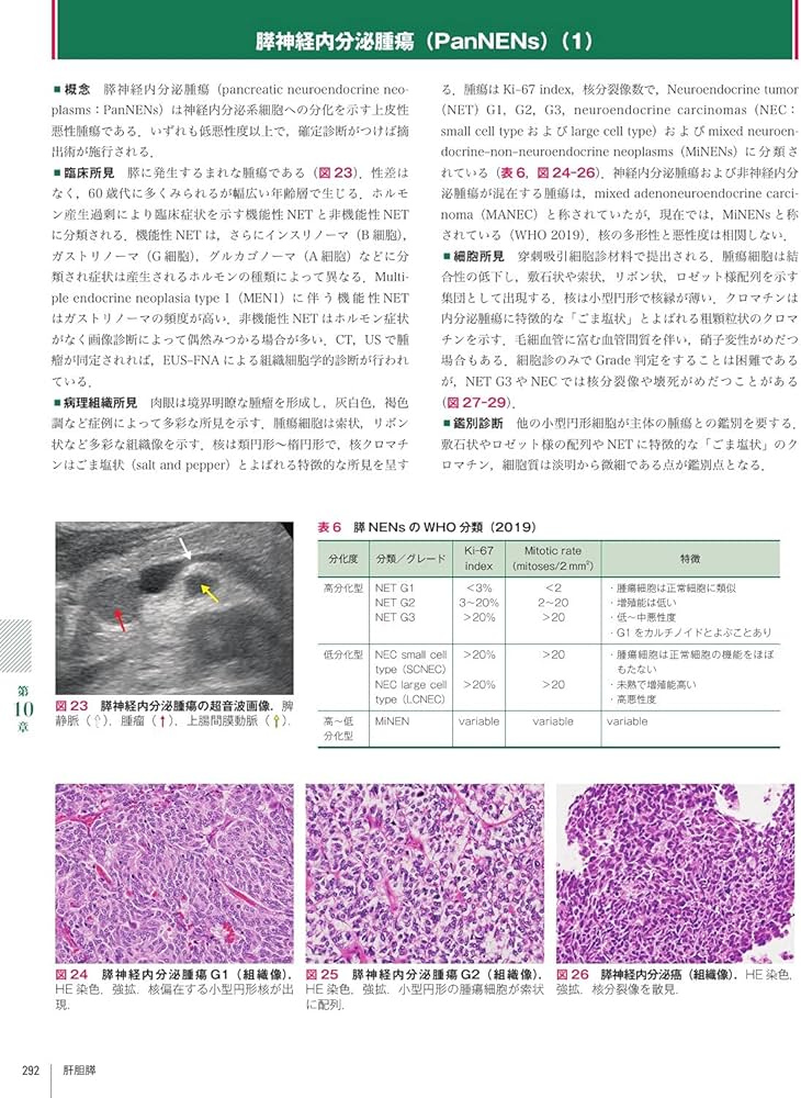 Amazon.co.jp: 細胞診鑑別アトラス : 金城 満: 本