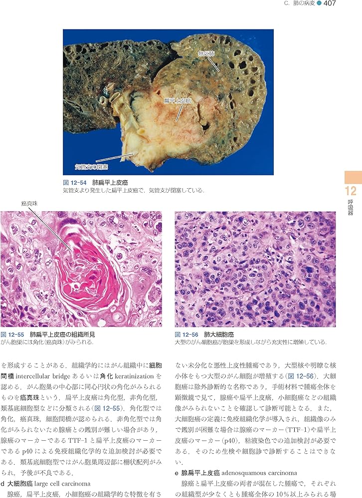 標準病理学 第7版 (Standard Textbook) | 北川 昌伸, 仁木 利郎, 小田