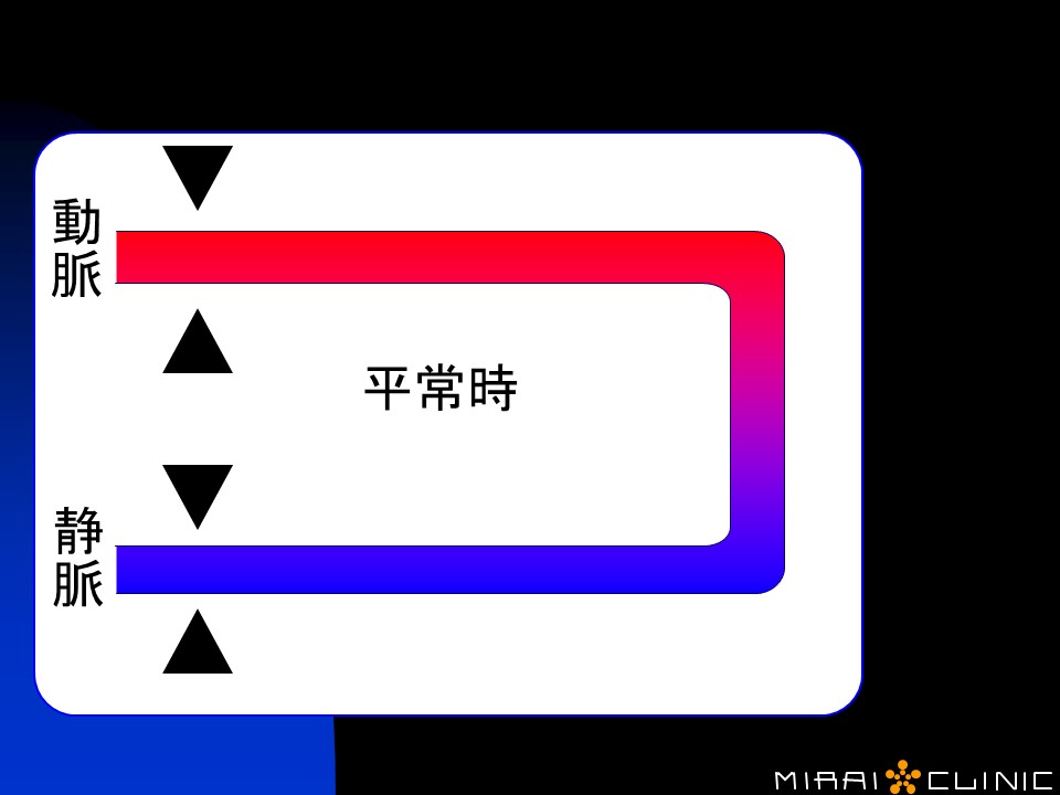 KAATSU CYCLE2 0】加圧サイクル2.0を紹介します【簡単に筋肉を増やす