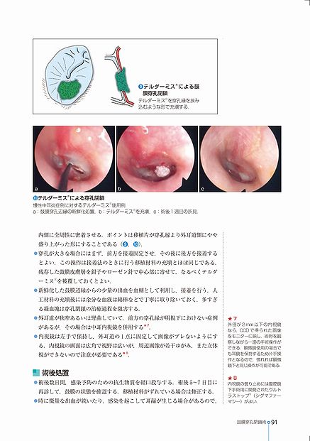 ENT臨床フロンティア | 株式会社中山書店